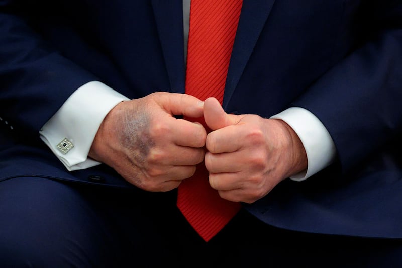 A bruise is visible on the back of U.S. President Donald Trump's right hand during a meeting with South Korean President Lee Jae-myung in the Oval Office at the White House on August 25, 2025 in Washington, DC. White House Press Secretary Karoline Leavitt was asked about the bruising in February and she responded, "President Trump has bruises on his hand because he’s constantly working and shaking hands all day every day." (Photo by Chip Somodevilla/Getty Images)