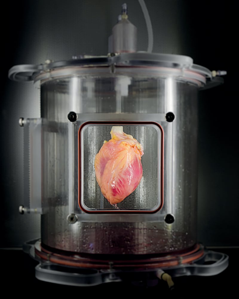 articles/2016/03/15/how-to-grow-a-new-heart-from-skin-cells/160314-abby-heart-tissue-embed_vkgr9o