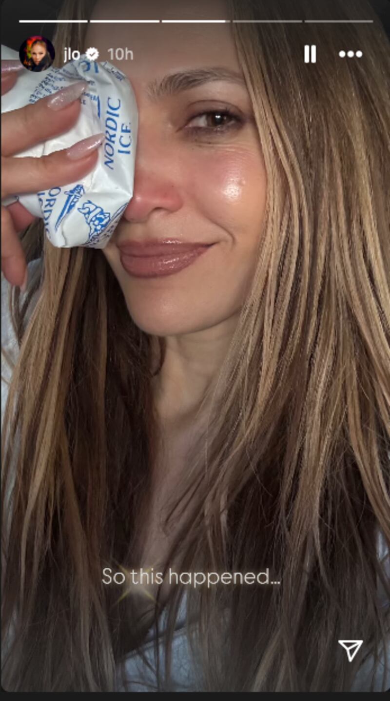 An Instagram photo of Jennifer Lopez icing her nose and face.