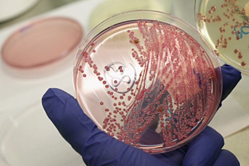 articles/2010/08/12/superbug-facts-to-know-as-ndm-1-emerges/superbug_185151_fi0cu1