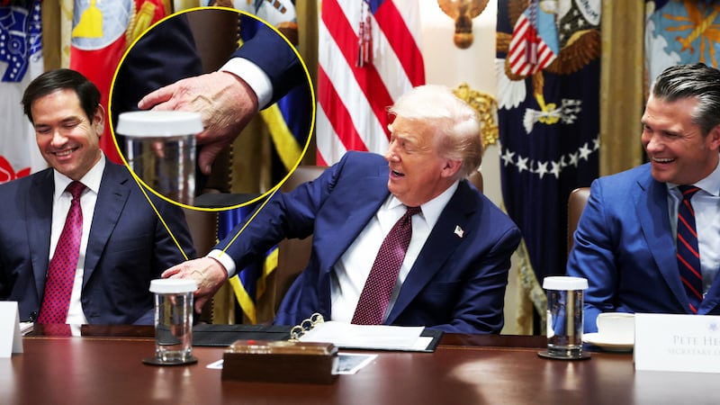 White House Press Secretary Karoline Leavitt has attributed the bruise on Trump's right hand to shaking hands “all day every day."