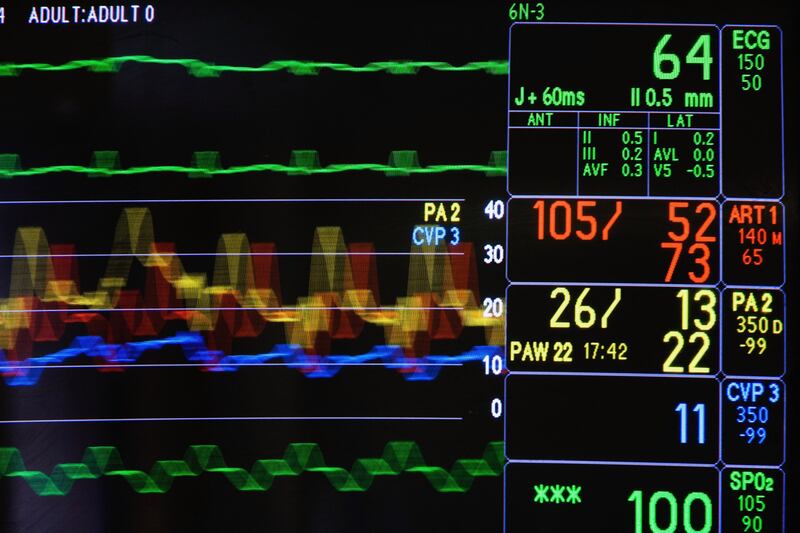 articles/2014/01/31/how-to-avoid-brain-death-purgatory/140131-brain-dead-tease-new_mrdyhw
