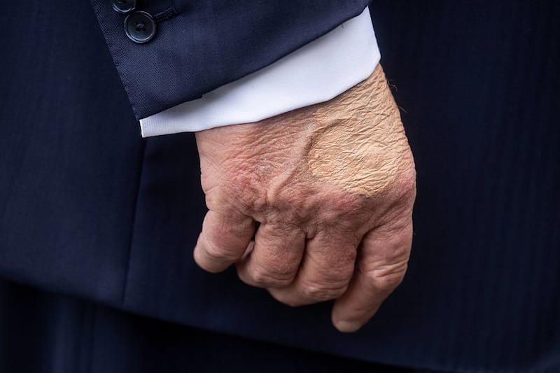 US President Donald Trump's right hand is seen as he speaks to the press before boarding Marine One on the South Lawn of the White House on July 15, 2025, in Washington, DC. Trump is travelling to Pittsburgh, Pennsylvania, to speak at the Pennsylvania Energy and Innovation Summit on the campus of Carnegie Mellon University. (Photo by Jim WATSON / AFP) (Photo by JIM WATSON/AFP via Getty Images)