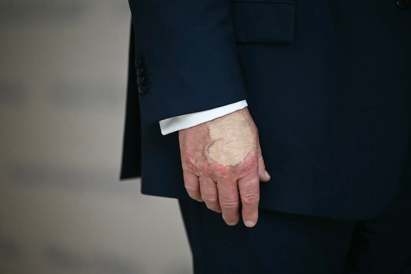President Donald Trump's hand was slathered in coverup as he spoke at "The People's House," a White House immersive experience across the street from the Eisenhower Executive Office Building, during a tour on August 22, 2025, in Washington, DC.