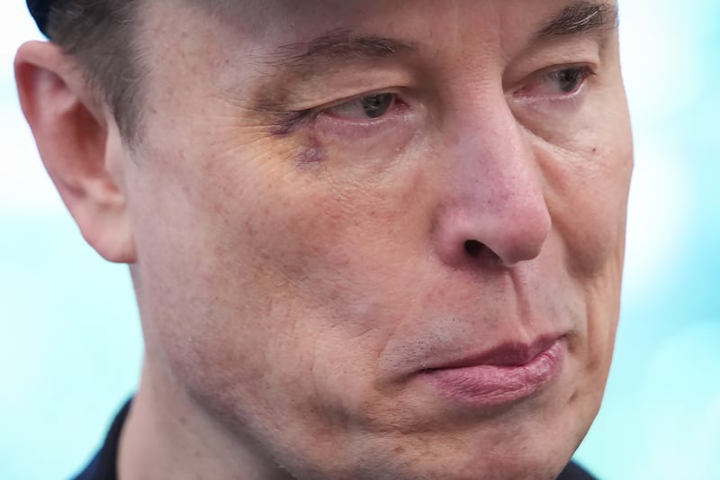 Elon Musk sported a black eye while appearing with President Donald Trump in the Oval Office of the White House on May 30, 2025 as the pair marked the end of Musk's official time as a "Special Government Employee" leading DOGE.