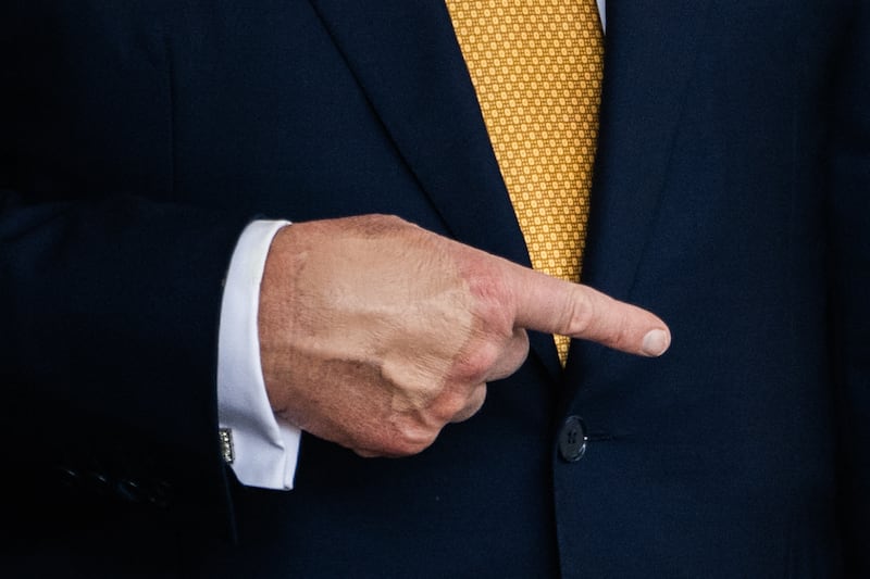 President Donald Trump's hand is caked in makeup.