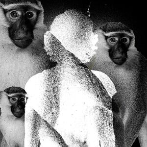 091122-hay-monkeypox-hero_kz1bxb