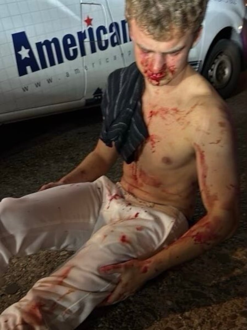 President Trump shared a photo of Edward “Big Balls” Coristine, bloodied and beaten, on his Truth Social account.