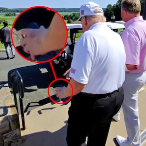 Donald Trump sports a new bruise on his left hand in an instagram post by Roger Clemens.