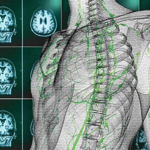 skeleton alzheimer's alzheimers disease no cure brain beta amyloid rudolph tanzi robert moir harvard