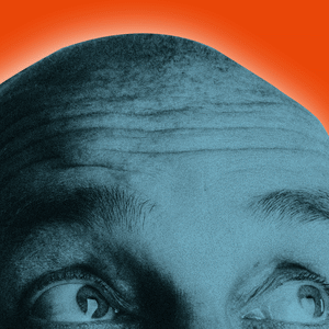 190702-Feder-Hair-Loss-tease_adrgog