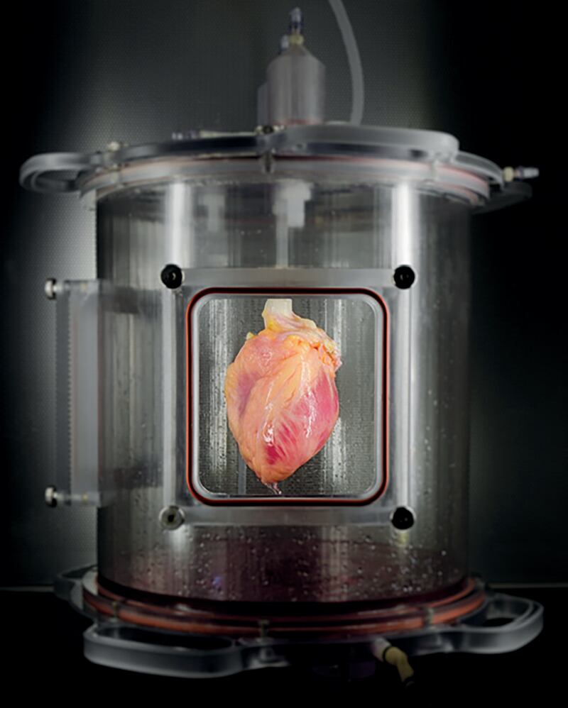 articles/2016/03/15/how-to-grow-a-new-heart-from-skin-cells/160314-abby-heart-tissue-embed_vkgr9o