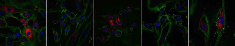 Slide_5_transient_reprogramming_partially_restores_collagen_nzp0ro