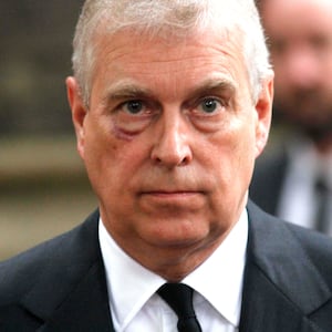 Prince Andrew, Duke of York, with a black eye in 2017. Prince Harry has denied getting into a physical fight with his uncle.
