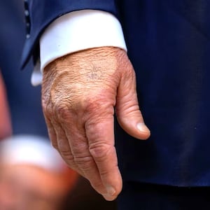 Make-up covers the back of the right hand of U.S. President Donald Trump during a tour of the Federal Reserve Board building in Washington, D.C., U.S., July 24, 2025. In a July 17, 2025 press briefing, U.S. Press Secretary Karoline Leavitt read a statement from his doctor that President Trump has a chronic venous insufficiency. REUTERS/Kent Nishimura