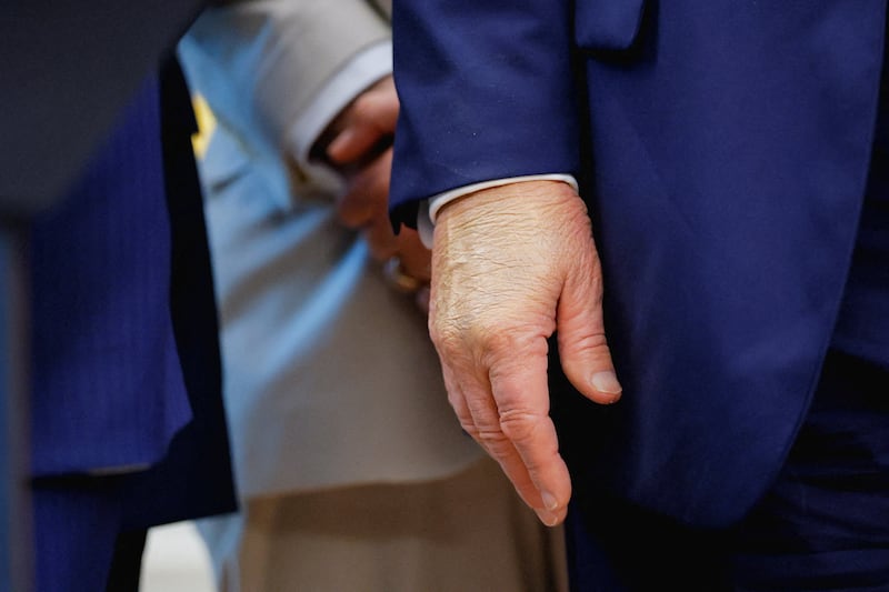 President Donald Trump's right hand was covered with makeup during an event on September 2 in the Oval Office.