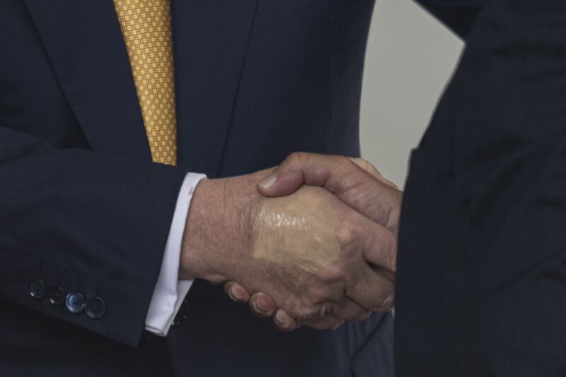 A bruise is seen on President Trump's right hand, which appears to be covered over with make-up, as he shakes the hand of Crown Prince and Prime Minister of the Kingdom of Bahrain Salman bin Hamad bin Isa Al Khalifa on Wednesday.